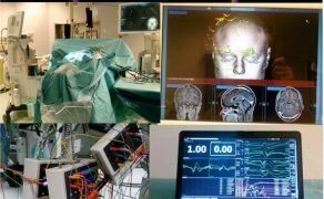 technika-neurochirurgia