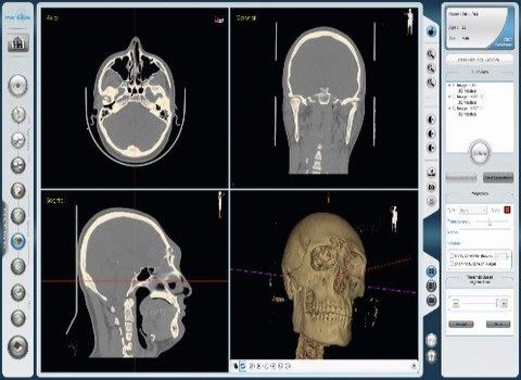 neuronawigacja-chirurgiczna