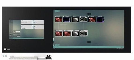 panele-chirurgiczne-kamery-wideo