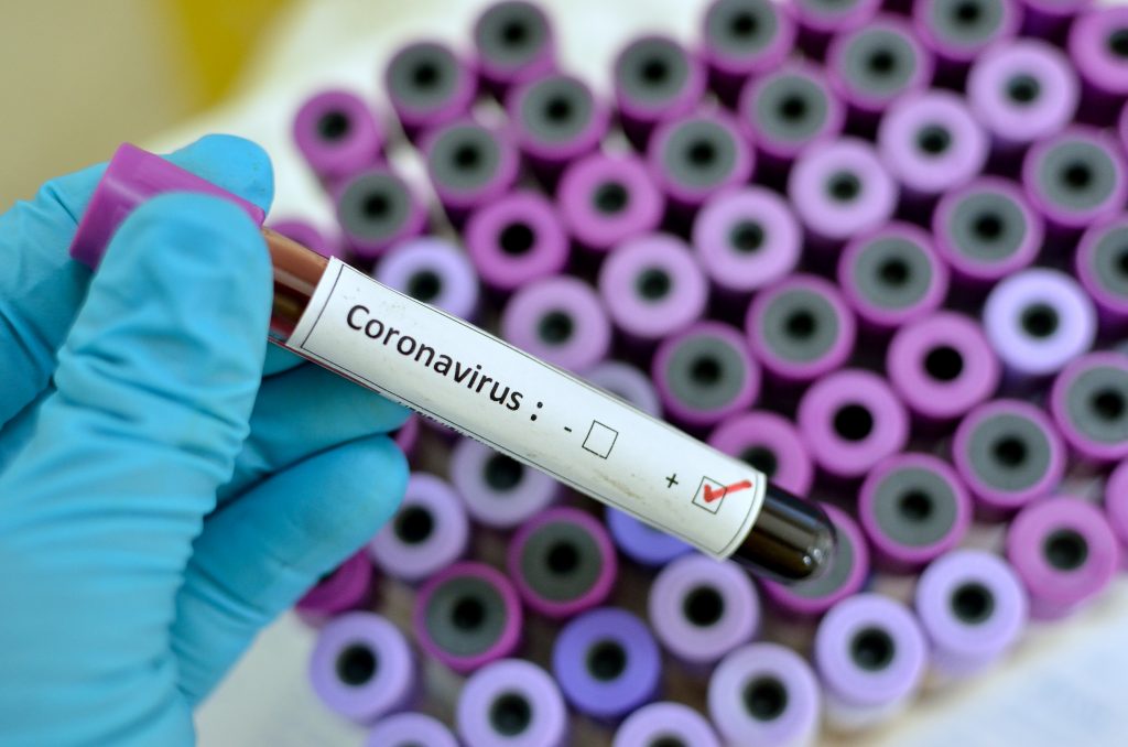 opm-test-na-koronawirusa