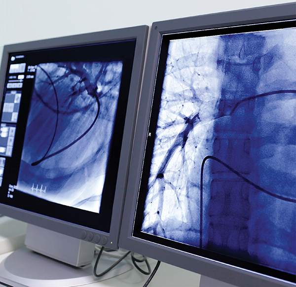 opm-dlaszpitali-diagnostyka-tetnic