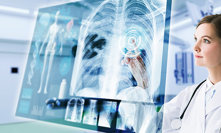 opm-dlaszpitali-sztuczna-inteligencja-wesprze-radiologow