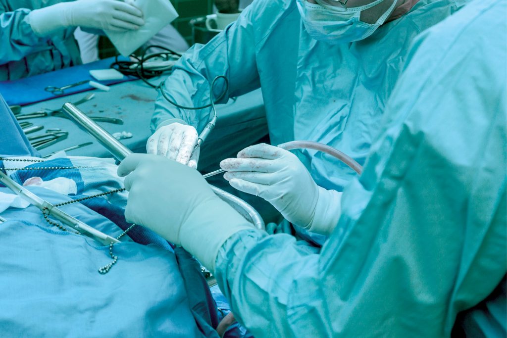 opm-dlaszpitali-endoskopia-zastosowanie-w-neurochirurgii