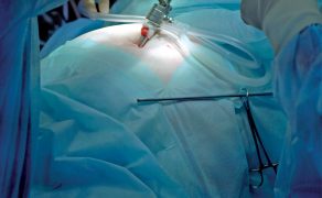 opm-dlaszpitali-laparoskopia-w-ginekologii-zastosowanie