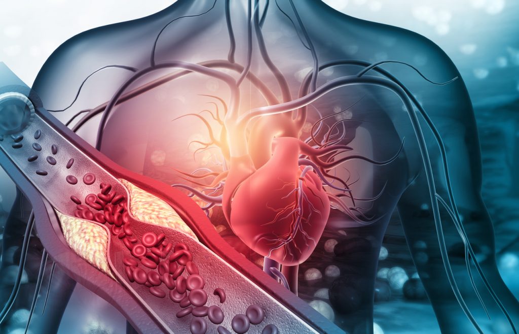 nowe-badania-dotyczace-niewydolnosci-serca-Levosimendan-szansa-na-poprawe-jakosci-leczenia
