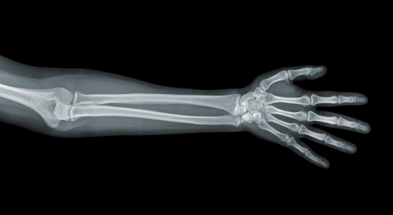 Wynalazek gdańskich naukowców ma pomóc w skutecznym leczeniu kości
