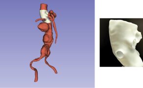 opm-dlaszpitali-medyczne-obrazowanie