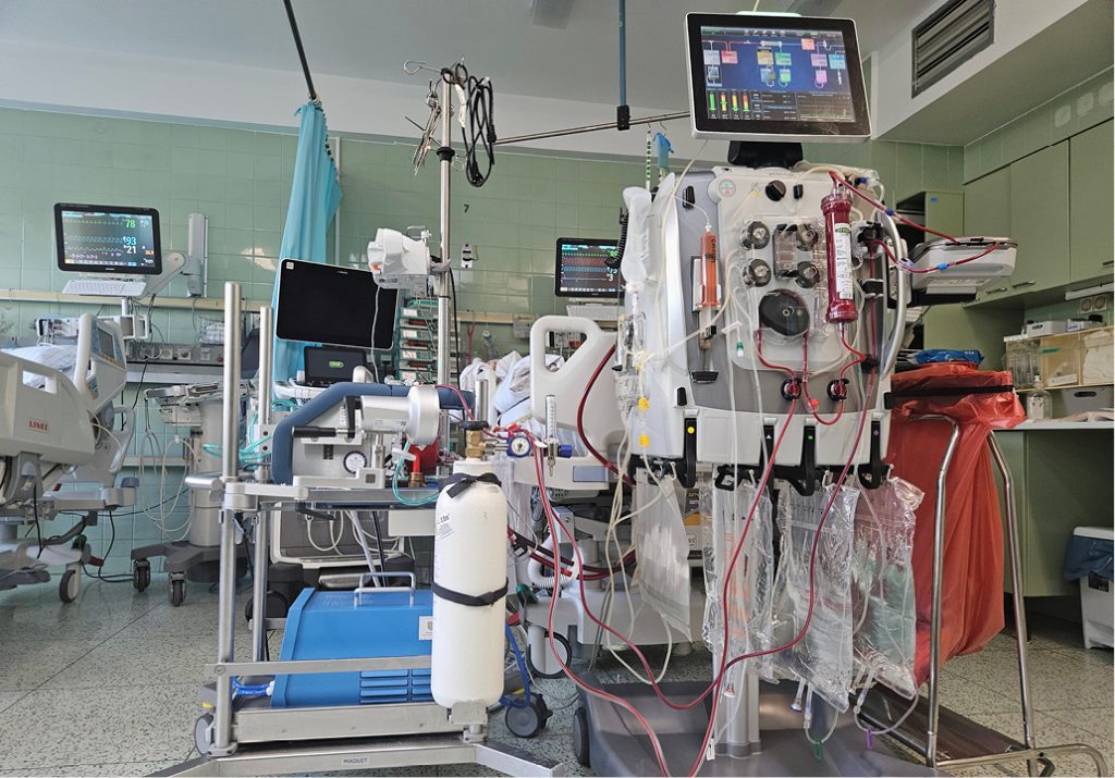 opm-dlaszpitali-dostępności-sprzętu