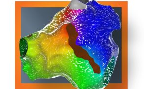 opm-dlaszpitali-mapowania-serca
