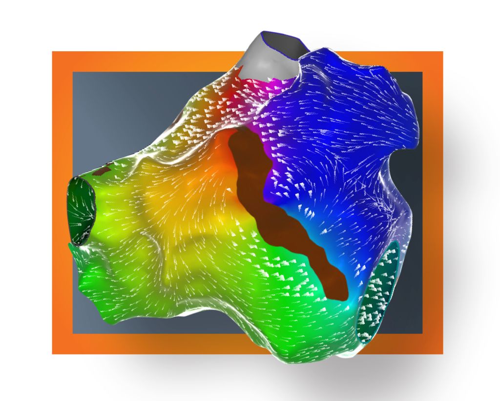 opm-dlaszpitali-mapowania-serca