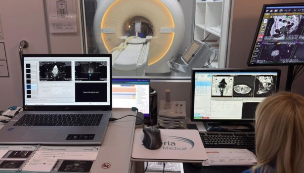 opm-dlaszpitali-biopsji-prostaty