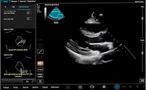OPM_2_26_technika_technologia_Slawomir_Mika_ROLA_SZTUCZNEJ_INTELIGENCJI_W_ANESTEZJOLOGII_I_INTENSYWNEJ_TERAPII_RYC_1