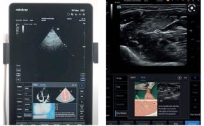 OPM_2_26_technika_technologia_Slawomir_Mika_ROLA_SZTUCZNEJ_INTELIGENCJI_W_ANESTEZJOLOGII_I_INTENSYWNEJ_TERAPII_RYC_2