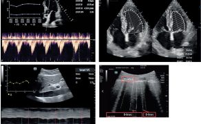 OPM_2_26_technika_technologia_Slawomir_Mika_ROLA_SZTUCZNEJ_INTELIGENCJI_W_ANESTEZJOLOGII_I_INTENSYWNEJ_TERAPII_RYC_3