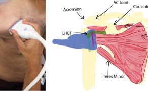 OPM_2_26_technika_technologia_Slawomir_Mika_ROLA_SZTUCZNEJ_INTELIGENCJI_W_ANESTEZJOLOGII_I_INTENSYWNEJ_TERAPII_RYC_4