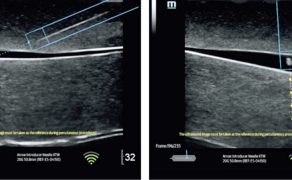 OPM_2_26_technika_technologia_Slawomir_Mika_ROLA_SZTUCZNEJ_INTELIGENCJI_W_ANESTEZJOLOGII_I_INTENSYWNEJ_TERAPII_RYC_5