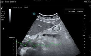 OPM_2_26_technika_technologia_Slawomir_Mika_ROLA_SZTUCZNEJ_INTELIGENCJI_W_ANESTEZJOLOGII_I_INTENSYWNEJ_TERAPII_RYC_6